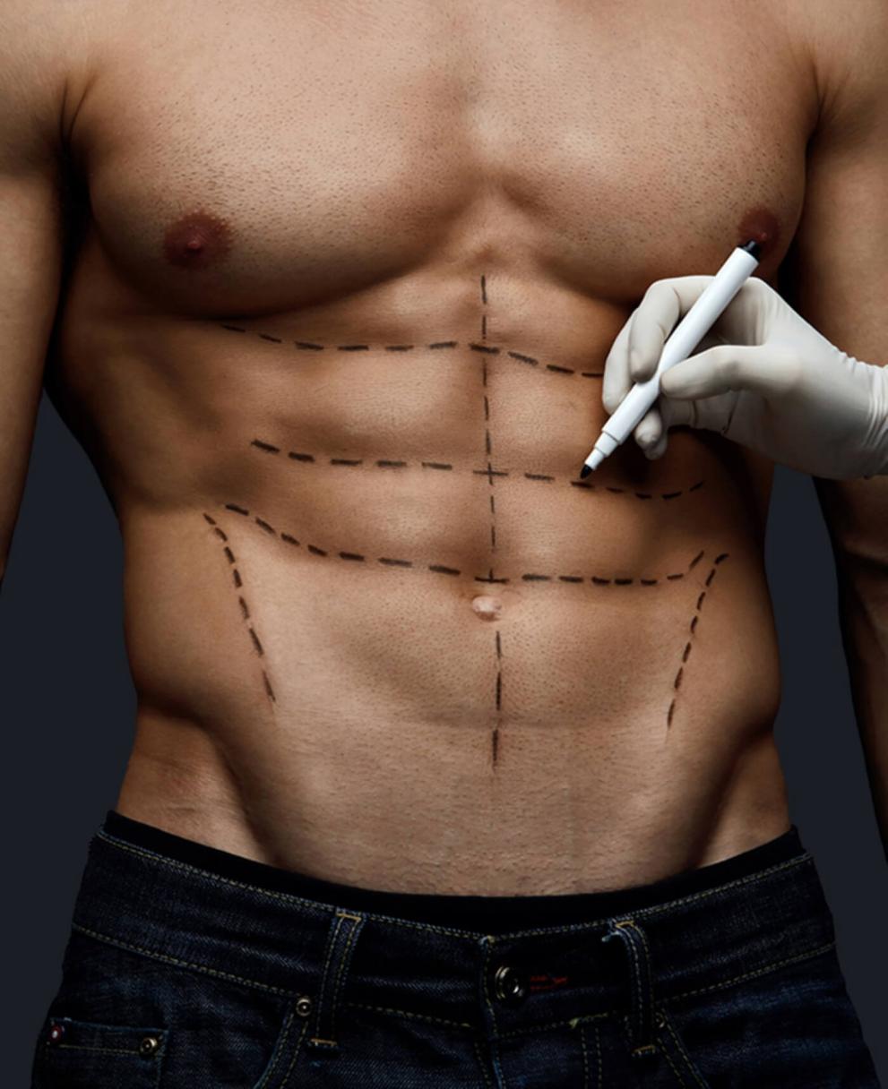 PLASTIC SURGERY MAN