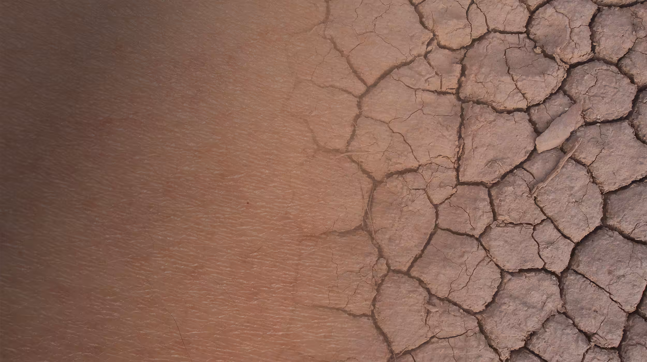 Skin Dehydration