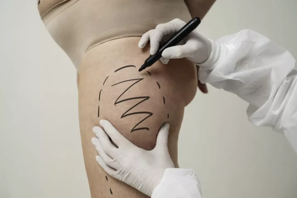 lipofilling banner 2.jpg 1