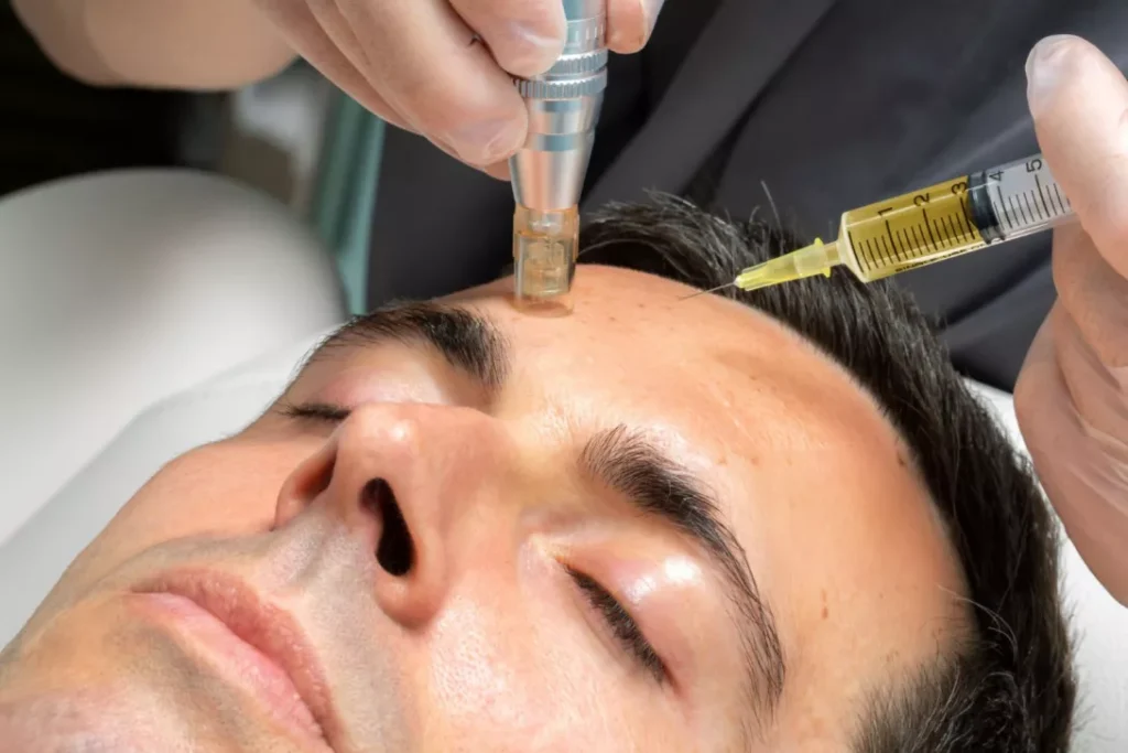  PRP (Platelet-Rich Plasma) Treatment