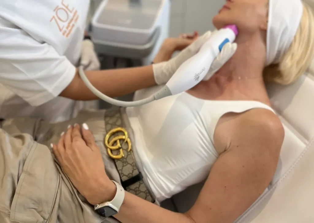 Thermage® FLX